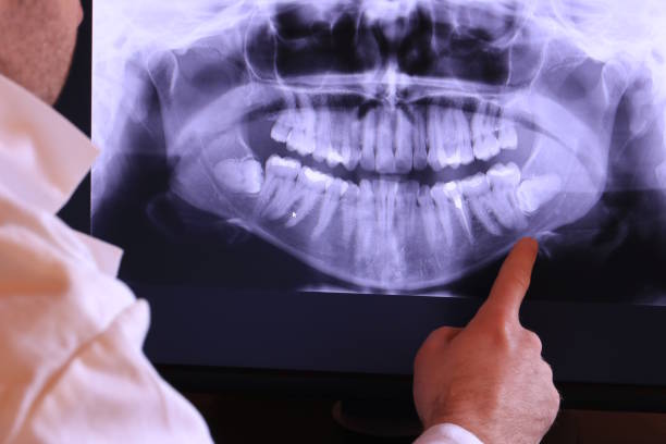 Best Broken or Chipped Tooth Repair in Priceville, AL